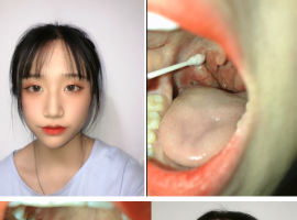 小美女拿棉签捅嗓子检查过程3V自拍视频【百度网盘下载】