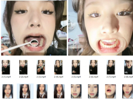 ♏恋物癖♏究极日系美少女+黑衣清纯学妹 口腔喉咙检查合集16V/2.6G【百度网盘下载】