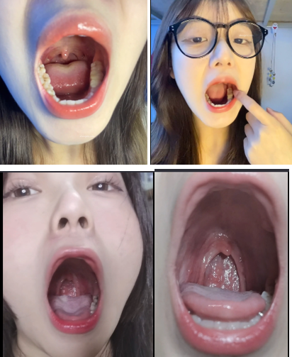 超清纯在校大学生2人口腔特写定制检查21V/1.2G【百度网盘下载】9575 作者:我是本性 帖子ID:603 口腔检查,口腔特写