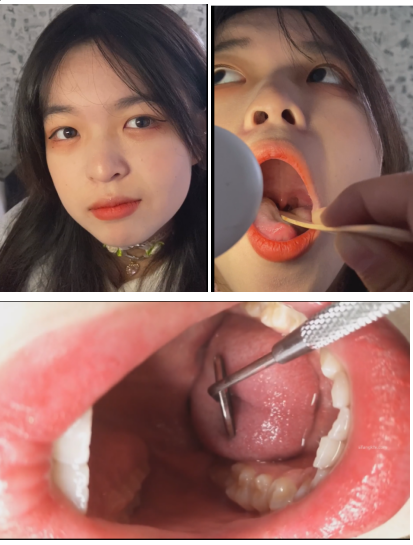美女小姐姐口腔检查嗓子眼检查视频2V/1.24G【百度网盘下载】5746 作者:我是本性 帖子ID:604 口腔特写,口腔检查