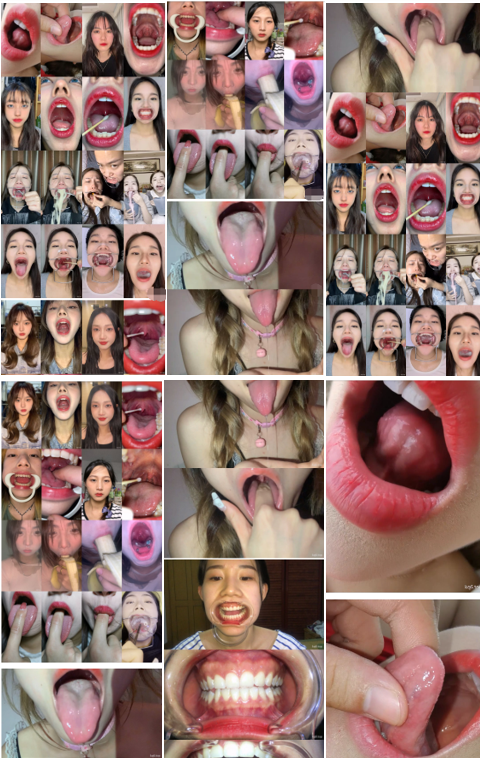 【恋物癖喉咙系列】】精选14位美女口腔检查合集 [16V+4.36G][百度网盘下载]4454 作者:我是本性 帖子ID:606 恋物癖,美女口腔,口腔检查