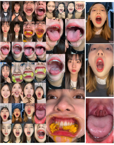 【口腔检查】精选12位美女口腔检查视频合集 [12V+2.48G][百度盘下载]3987 作者:我是本性 帖子ID:611 美女口腔,口腔特写,口腔检查,口腔视频