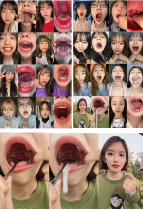 【恋物癖】46位美女口腔检查高清GIF动态图 [100P+2.96G][百度网盘下载 ]5331 作者:我是本性 帖子ID:1988 恋物癖,口腔检查,口腔