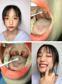 小美女拿棉签捅嗓子检查过程3V自拍视频【百度网盘下载】