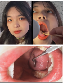 美女小姐姐口腔检查嗓子眼检查视频2V/1.24G【百度网盘下载】