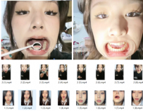 ♏恋物癖♏究极日系美少女+黑衣清纯学妹 口腔喉咙检查合集16V/2.6G【百度网盘下载】